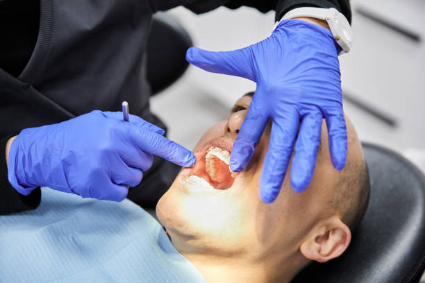 Best Urgent Care for Lost Fillings or Crowns in Weissport East, PA